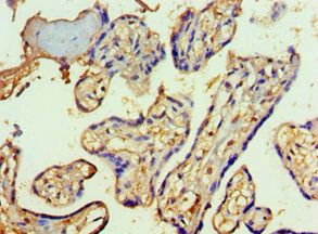 SF3B3 antibody