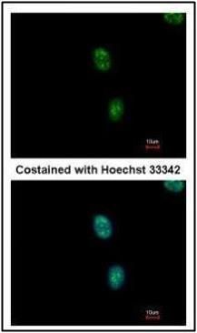 SF3B3 antibody