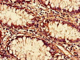 SF3B6 Antibody