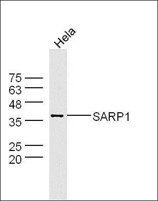 SFRP2 antibody