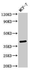 SFRP4 Antibody