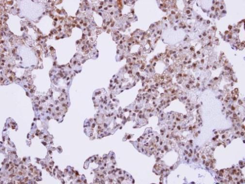 SFRS17A Rabbit Polyclonal Antibody