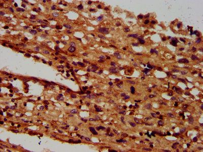 SGCB Antibody