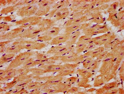 SGCG Antibody