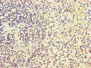 SGF29 Antibody