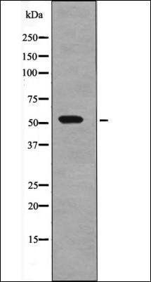 SGK1 (Phospho-Thr256) antibody