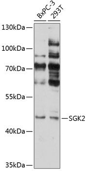 SGK2 antibody
