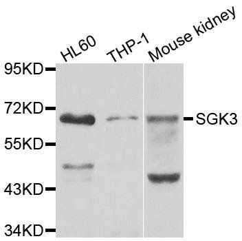 SGK3 antibody