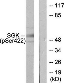 SGK (phospho-Ser422) antibody