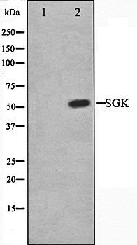 SGk antibody