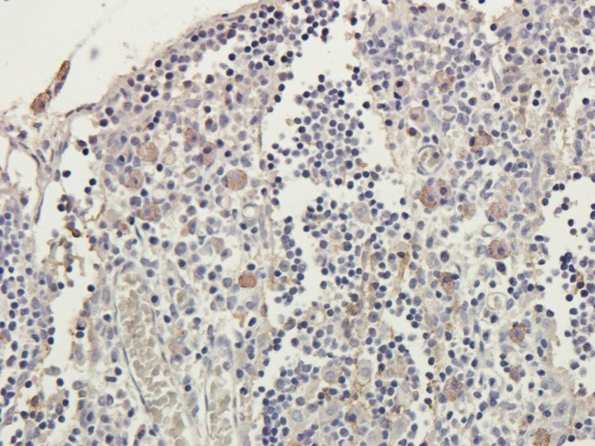 SGPP1 Rabbit Polyclonal Antibody