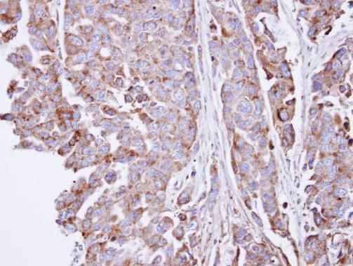 SGSH antibody [C1C3]