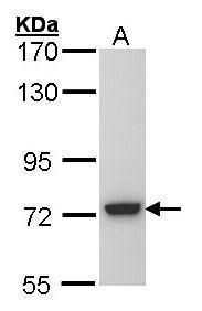 SGSH Rabbit Polyclonal Antibody