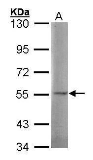 SGSH Rabbit Polyclonal Antibody