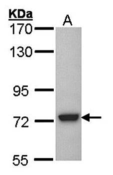 SGSH antibody