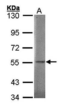 SGSH antibody
