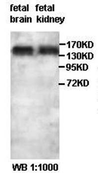 SGSM1 antibody