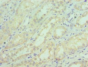 SGTA Antibody
