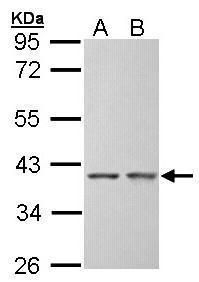 SGTA Rabbit Polyclonal Antibody