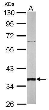 SGTA Rabbit Polyclonal Antibody