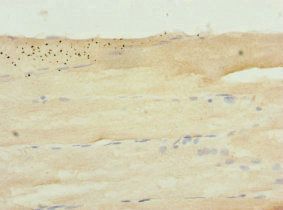 SH2B1 Antibody