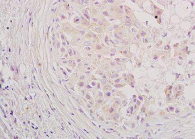 SH2B1 Rabbit Polyclonal Antibody