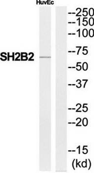 SH2B2 antibody