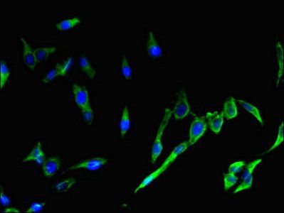 SH2D1A antibody