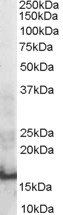 Goat anti-SH2D1A / SAP Antibody