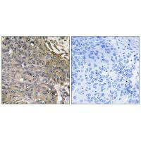 SH2D1B Antibody