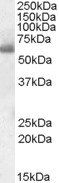 SH2D3A antibody