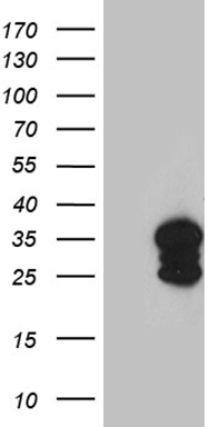 SH3BGR antibody