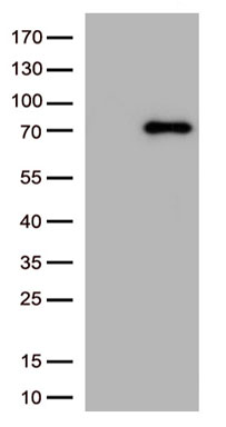 SH3BGR antibody