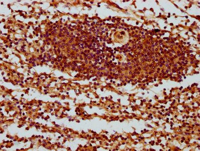 SH3BP1 Antibody