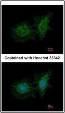 SH3 domain binding protein 1 Antibody