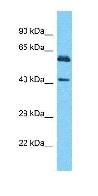 SH3BP5L antibody