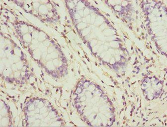 SH3GL1 Antibody