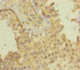 SH3GL3 Antibody