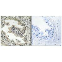 SH3GLB2 Antibody
