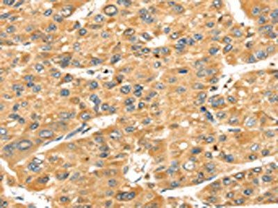 SH3KBP1 Antibody