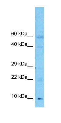 SH3L3 antibody