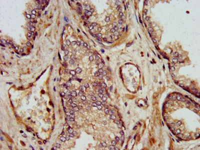 SHARPIN Antibody