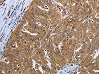 SHBG Antibody