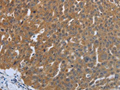 SHBG Antibody