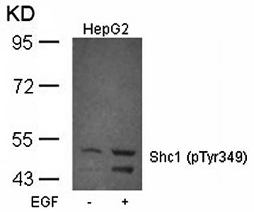 Shc1 (Phospho-Tyr349) Antibody