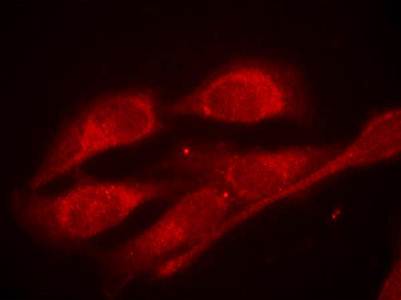 Shc1 (Phospho-Tyr427) Antibody