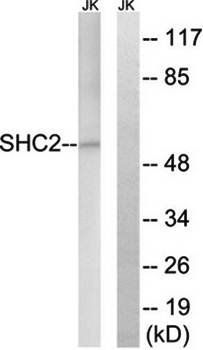 SHC2 antibody