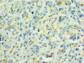 SHC4 Antibody