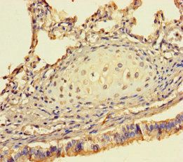 SHFM1 antibody