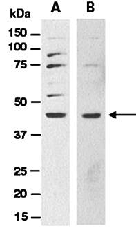 SHH (vPairTM) Antibodies